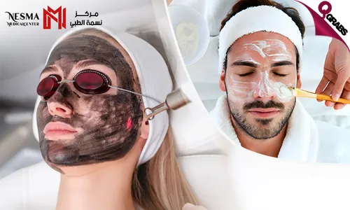 Carbon Laser & Hair Bleaching for Ladies & Men at Nesma Medical Center